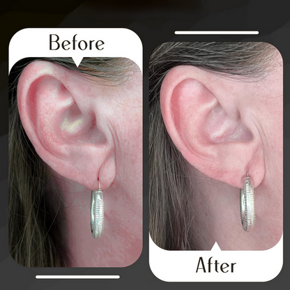 Premium Earlobe Support Patches | BUY 50 GET 50 FREE